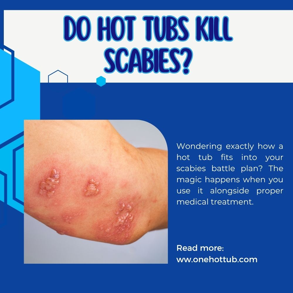 hot tub with scabies
